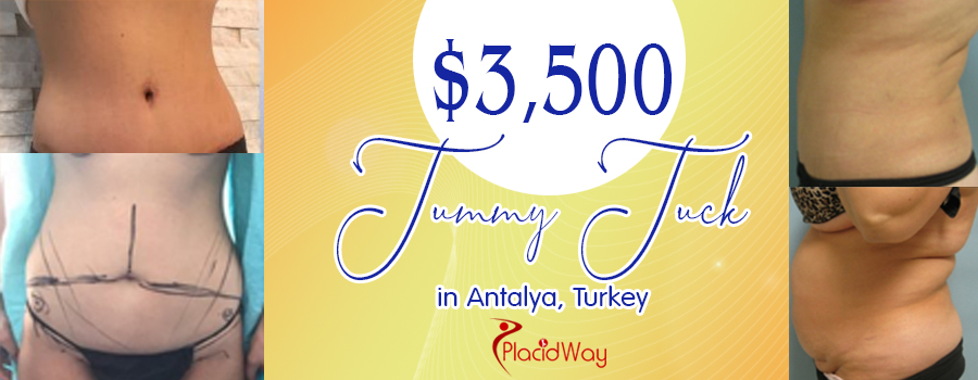 Tummy Tuck Cost in Antalya, Turkey
